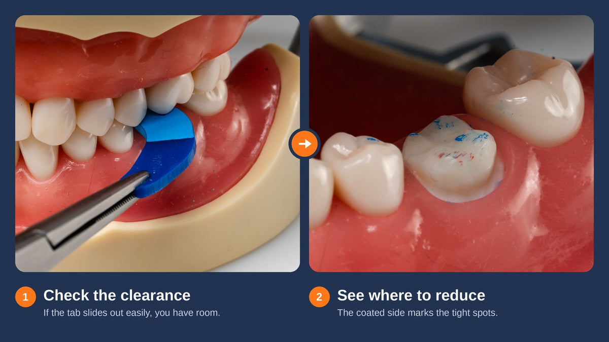 How to Verify Crown Prep Reduction Before the Impression