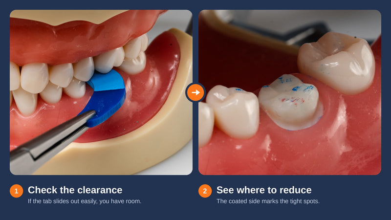 How to Verify Crown Prep Reduction Before the Impression